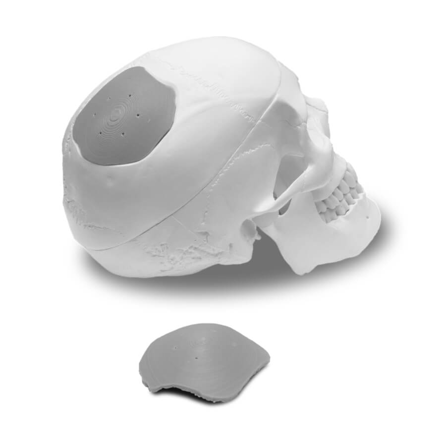 cleanroom-skull-implant-k